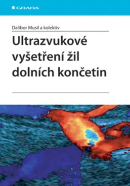 Ultrazvukové vyšetření žil dolních končetin, kolektiv pedagogů: