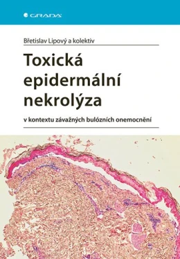 Toxická epidermální nekrolýza, Lipový Břetislav