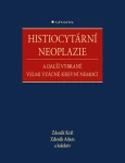Histiocytární neoplazie a další vybrané velmi vzácné krevní nemoci, Král Zdeněk