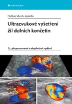 Ultrazvukové vyšetření žil dolních končetin, Musil Dalibor
