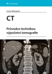 CT - Průvodce technikou výpočetní tomografie, Súkupová Lucie
