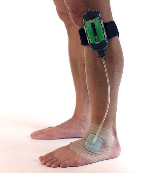 SNAP WOUND CARE STRAP 1KS LARGE STPALEE