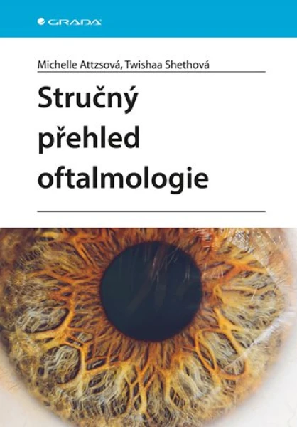 Stručný přehled oftalmologie, Attzsová Michelle