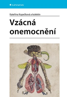 Vzácná onemocnění, Kopečková Kateřina