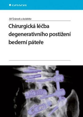 Chirurgická léčba degenerativního postižení bederní páteře, Šrámek Jiří