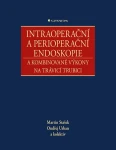 Intraoperační a perioperační endoskopie a kombinované výkony na trávicí trubici, Stašek Martin
