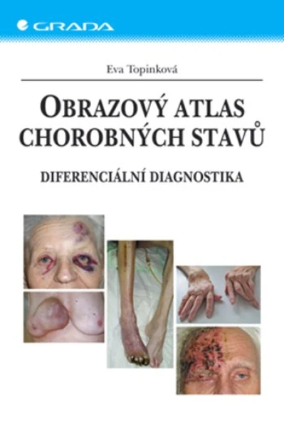 Obrazový atlas chorobných stavů, Topinková Eva