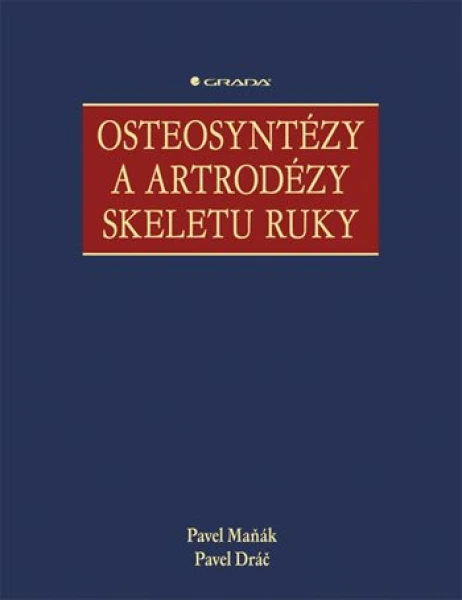 Osteosyntézy a artrodézy skeletu ruky, Maňák Pavel