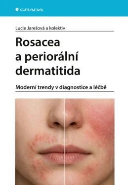 Rosacea a periorální dermatitida, Jarešová Lucie