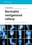 Normální rentgenové nálezy, Möller Torsten B.