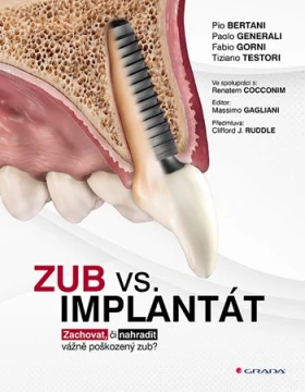 Zub vs. implantát, Bertani Pio
