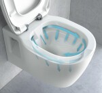 REA - Závesná WC misa Carter so sedátkom SLIM, rimless, biela REA-C1400