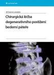 Chirurgická léčba degenerativního postižení bederní páteře, Šrámek Jiří