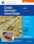 Česká dermatovenerologie 2021/2, Hercogová Třešňák Jana