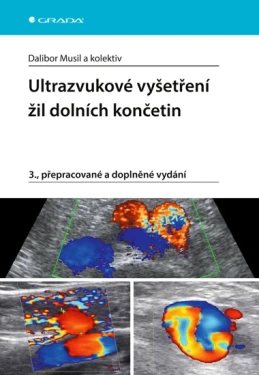 Ultrazvukové vyšetření žil dolních končetin, Musil Dalibor