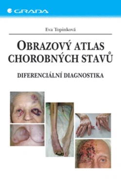 Obrazový atlas chorobných stavů, Topinková Eva