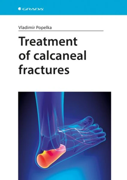 Treatment of calcaneal fractures, Popelka Vladimír