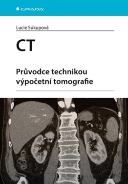 CT - Průvodce technikou výpočetní tomografie, Súkupová Lucie
